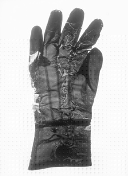 first medical glove in the world from rubber